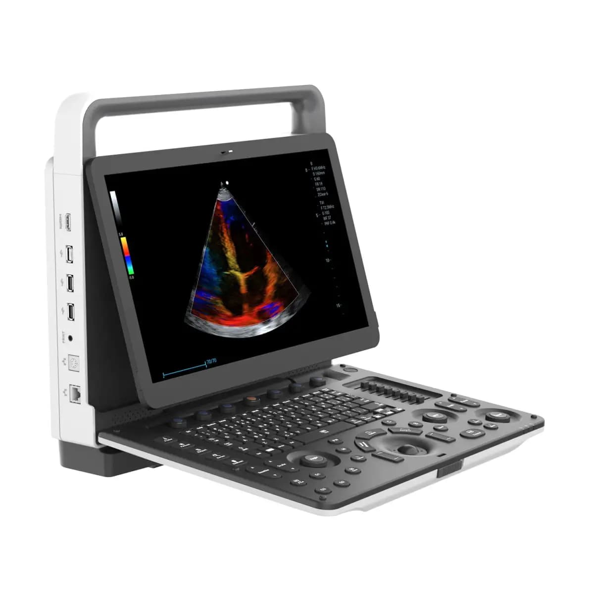 YSB-M30 4D Portable Color Doppler Ultrasound System